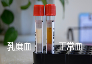 哪些人容易产生乳糜血 怎样预防乳糜血