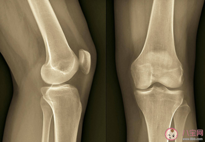 为什么爸妈一吹空调就觉得关节疼 吹空调出现关节疼怎么办