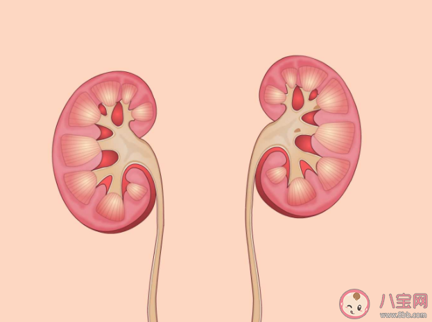 夏季为什么尿路结石高发 尿路结石如何预防 夏季为什么尿路结石高发 尿路结石如何预防