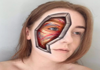 颜面骨折3D重建能恢复到原来的样子吗 3D重建技术原理是什么