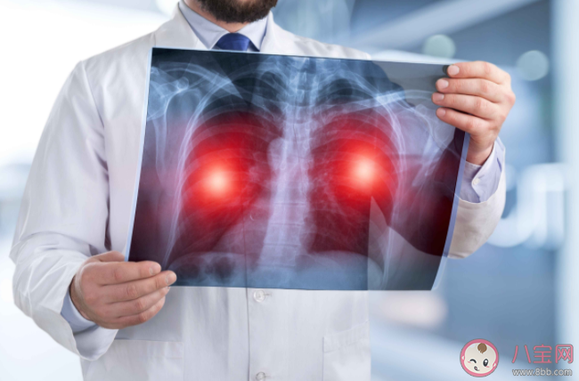 长期戴口罩可致肺结节增大吗 肺结节的致病原因是什么 长期戴口罩可致肺结节增大吗 肺结节的致病原因是什么