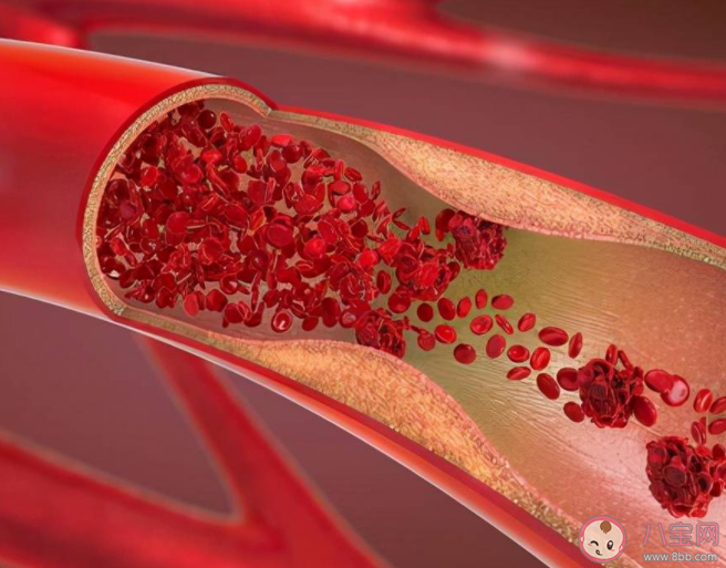 这些血管软化方法不可信 想要血管健康要做好这些事