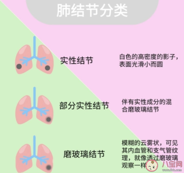 肺结节与养宠物有关吗 养宠物要注意哪些卫生问题