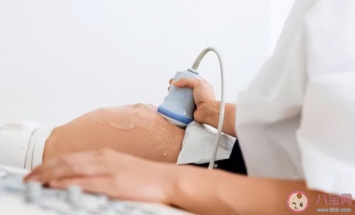 怀孕查出子宫肌瘤宝宝会有影响吗 孕期子宫肌瘤什么情况要终止妊娠