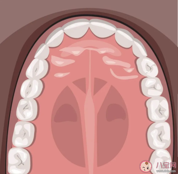 后牙槽上有黑线是什么 窝沟封闭可以预防窝沟龋坏吗