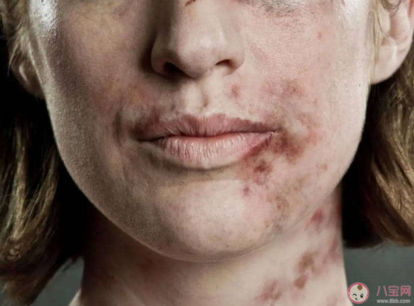 遭遇家暴如何申请人身安全保护令 人身安全保护令的时效是多久