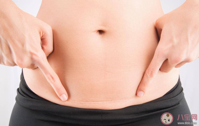 剖腹产可以让医生顺便把肚子上的脂肪割掉一些吗 剖腹产术后要注意什么