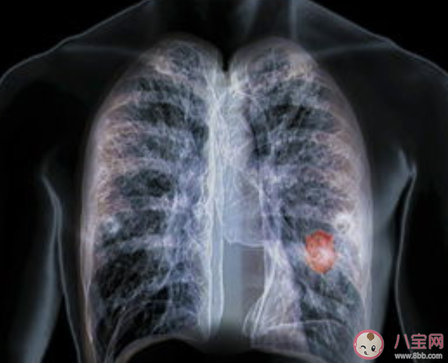 空气污染会引发肺癌吗 空气污染还会带来哪些身体伤害