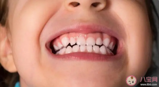 为什么不建议学龄前儿童自己刷牙 有哪些不易察觉的毁牙误区