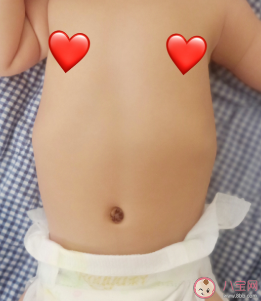 半岁宝宝穿裤子会造成肋骨外翻吗 孩子的肋骨外翻是什么原因造成的 半岁宝宝穿裤子会造成肋骨外翻吗 孩子的肋骨外翻是什么原因造成的