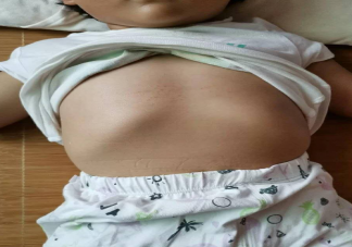 半岁宝宝穿裤子会造成肋骨外翻吗 孩子的肋骨外翻是什么原因造成的