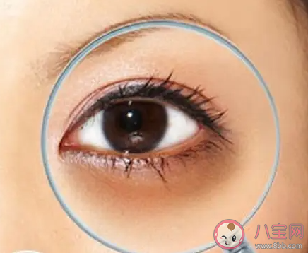 黑眼圈无法彻底根除吗 为什么会产生黑眼圈