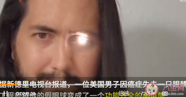 美国一男子将义眼改装成手电筒是怎么回事 义眼一般是用什么做的
