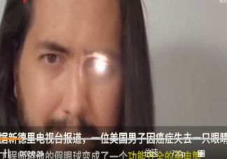 美国一男子将义眼改装成手电筒是怎么回事 义眼一般是用什么做的