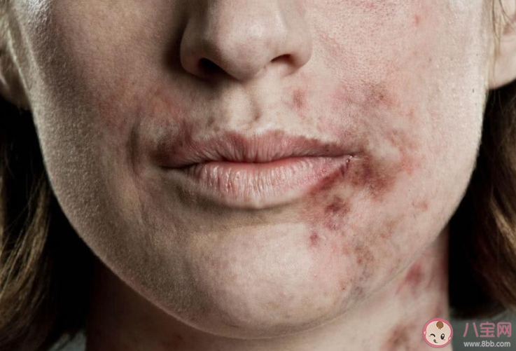 夫妻间经常谩骂侮辱也算家暴吗 家暴具体都包括哪些方面