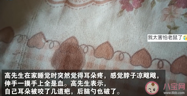 男子熟睡时疑被老鼠咬破头是怎么回事 老鼠会咬人吗