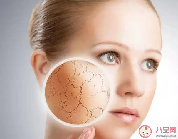 冬季皮肤干燥该怎么办 如何缓解冬季皮肤干燥