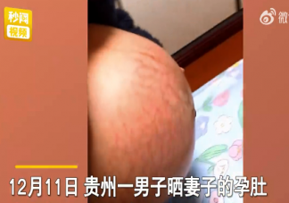 男子称妻子孕肚像被蜈蚣爬满太恐怖 妊娠纹该如何消除