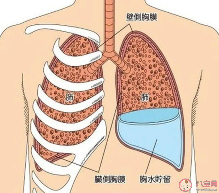 为什么近期白肺患者逐渐增多 导致白肺的原因是什么