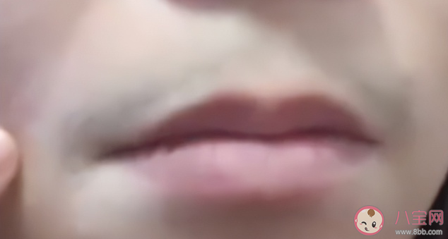 女生回应感染新冠后长出胡子是怎么了 女性长胡子是什么原因