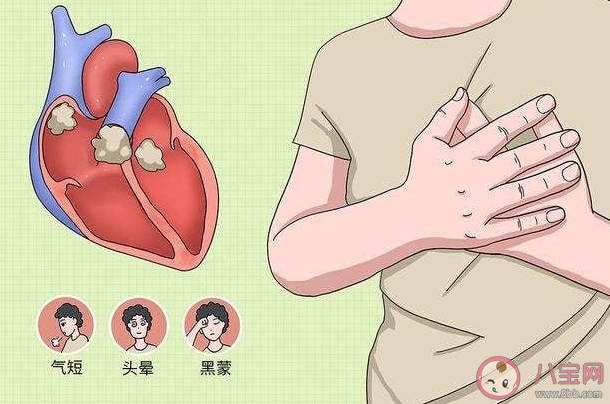 如何鉴别病毒性心肌炎 为什么会有病毒性心肌炎