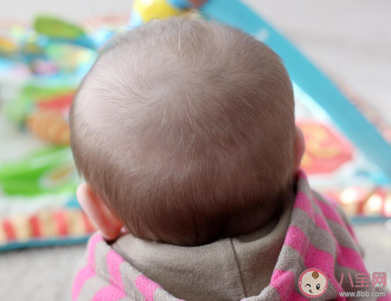 1岁多孩子经常掉头发是怎么回事 宝宝脱发会变成秃子吗 1岁多孩子经常掉头发是怎么回事 宝宝脱发会变成秃子吗