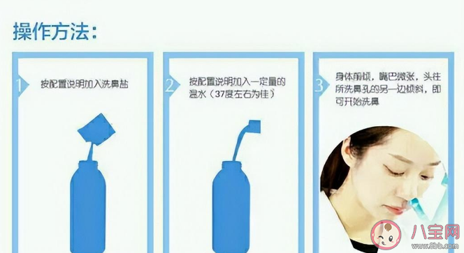 冲洗鼻腔的水可以用自来水吗 鼻腔冲洗具体方法操作 冲洗鼻腔的水可以用自来水吗 鼻腔冲洗具体方法操作