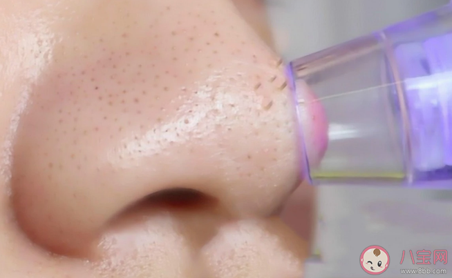 5个祛黑头的正确方法 去黑头产品真的靠谱吗