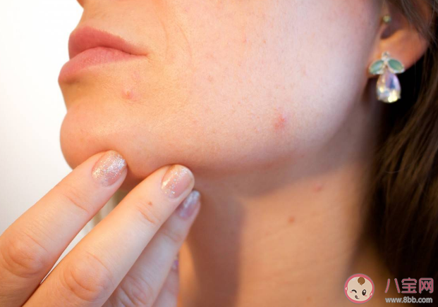 毛孔粗大用护肤品真的管用吗 护肤品怎么改善毛孔粗大 毛孔粗大用护肤品真的管用吗 护肤品怎么改善毛孔粗大
