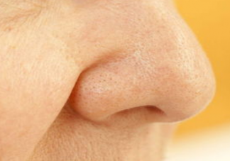 毛孔粗大用护肤品真的管用吗 护肤品怎么改善毛孔粗大