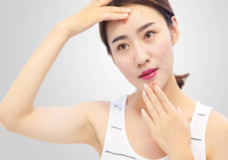 哪些医美项目有抗炎作用 日常皮肤如何抗炎