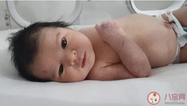 数千人提出领养叙利亚奇迹宝宝 领养孩子需要哪些条件