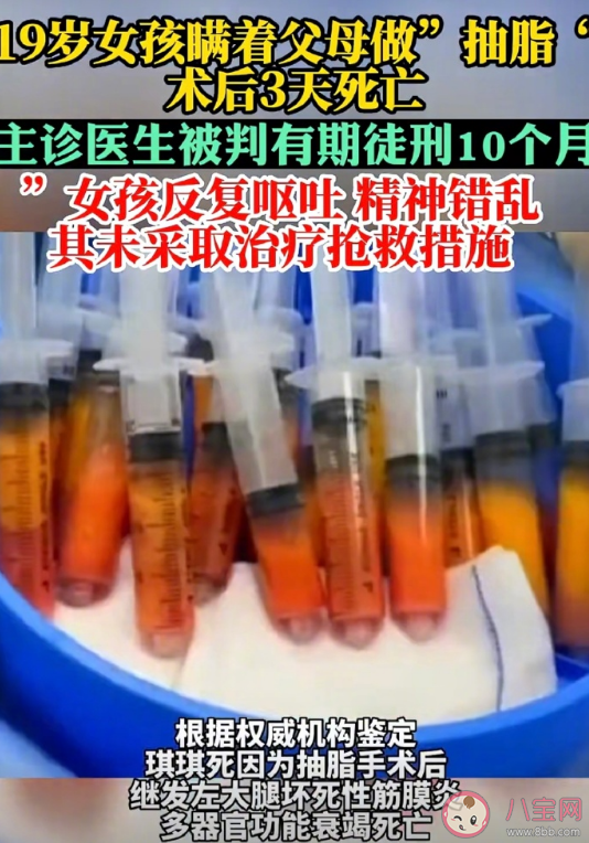 19岁女孩整形医院抽脂3天后死亡 抽脂会有什么风险并发症