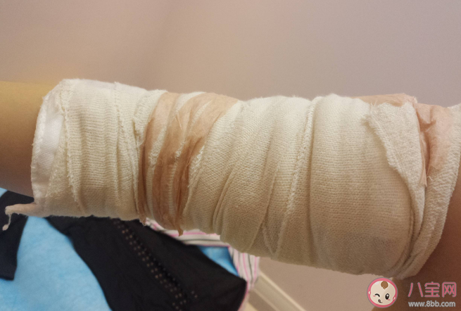 吸脂手术适用什么人适合减肥吗 吸脂手术的原则