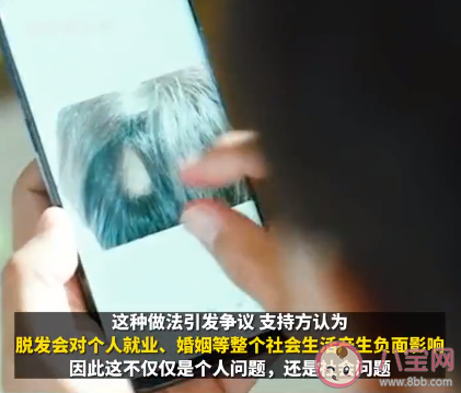 韩国多地给青年人发脱发治疗费 年轻人脱发问题怎么解决