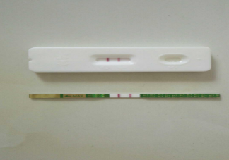 验孕棒可以检测出睾丸癌吗 睾丸癌的症状有哪些