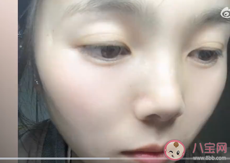 女子左眼瞳孔变大2倍找不到病因 瞳孔变大了会怎样