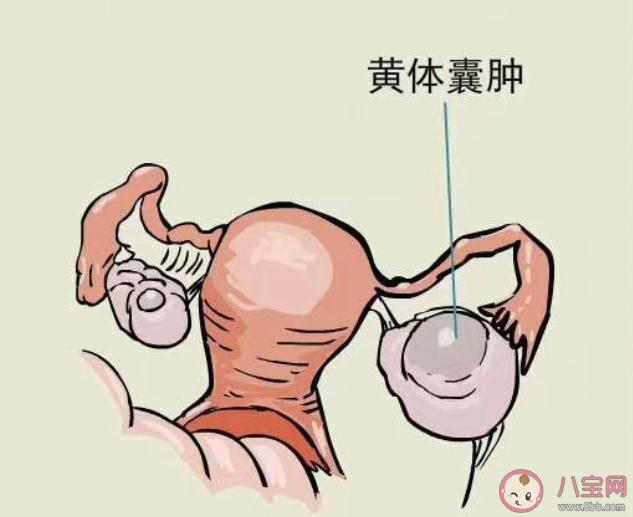 黄体为什么会破裂 黄体破了该怎么办