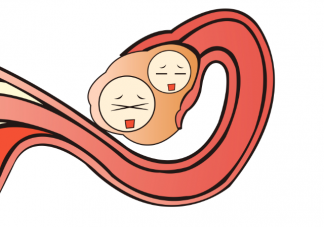 女性黄体破裂的原因是什么 黄体破裂好发于什么年龄