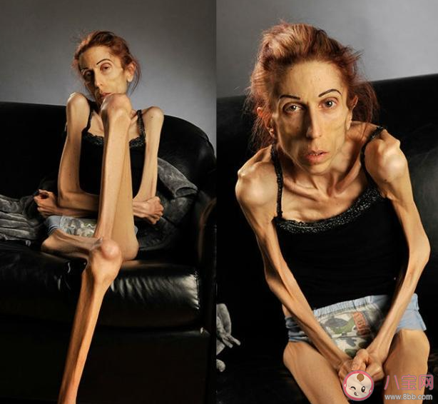 22岁姑娘因男友减到55斤进医院 要不要为爱减肥