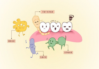 牙齿上黑黑的是牙结石吗 牙结石是怎么产生的