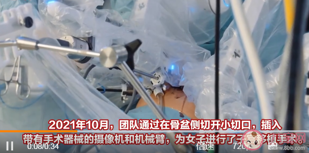 全球首例机械臂辅助移植子宫诞下婴儿 子宫移植手术成功率高吗