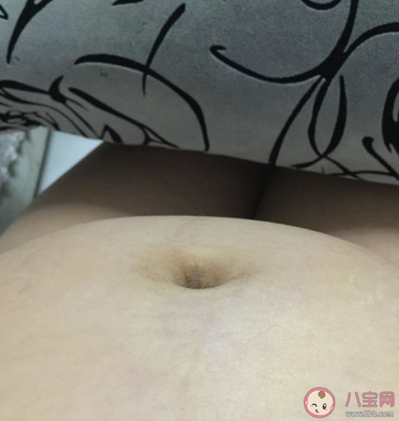 为什么肚脐是污泥制造机 肚脐眼为什么不能乱抠