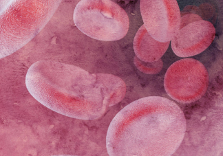 颈动脉斑块有什么危害 动脉中的斑块是怎么出现的