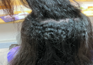 为啥人类进化出卷发 为什么有些人天生卷发