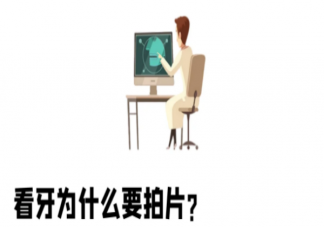 看牙为什么要拍片 口腔科中的拍片类型包括哪些