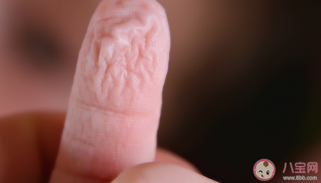 洗完澡后手指头变皱正常吗 为什么洗澡时间长了皮肤会变皱