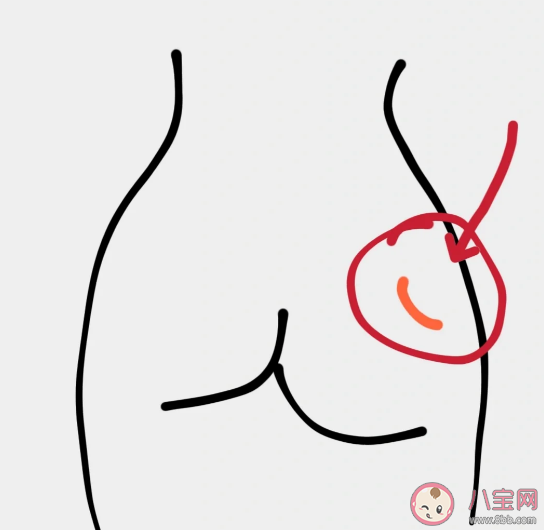 死臀综合征是什么意思 死臀综合征有什么危害