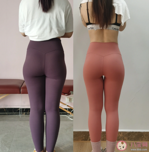 死臀综合征是什么意思 死臀综合征有什么危害