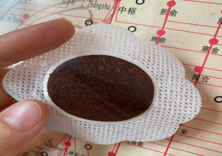哪些体质适合三伏贴2023 三伏贴为什么要去专门医疗机构